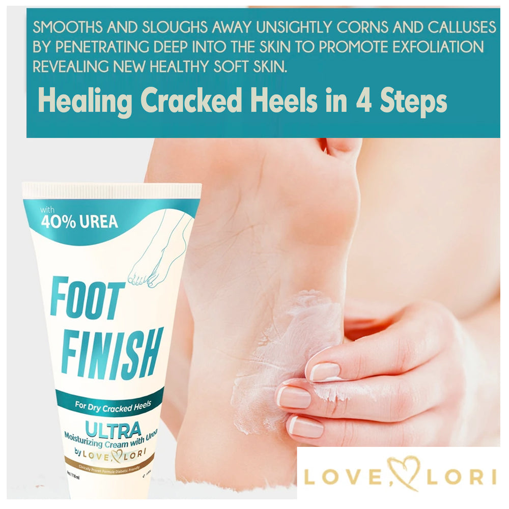 How To Help Dry, Cracked Feet