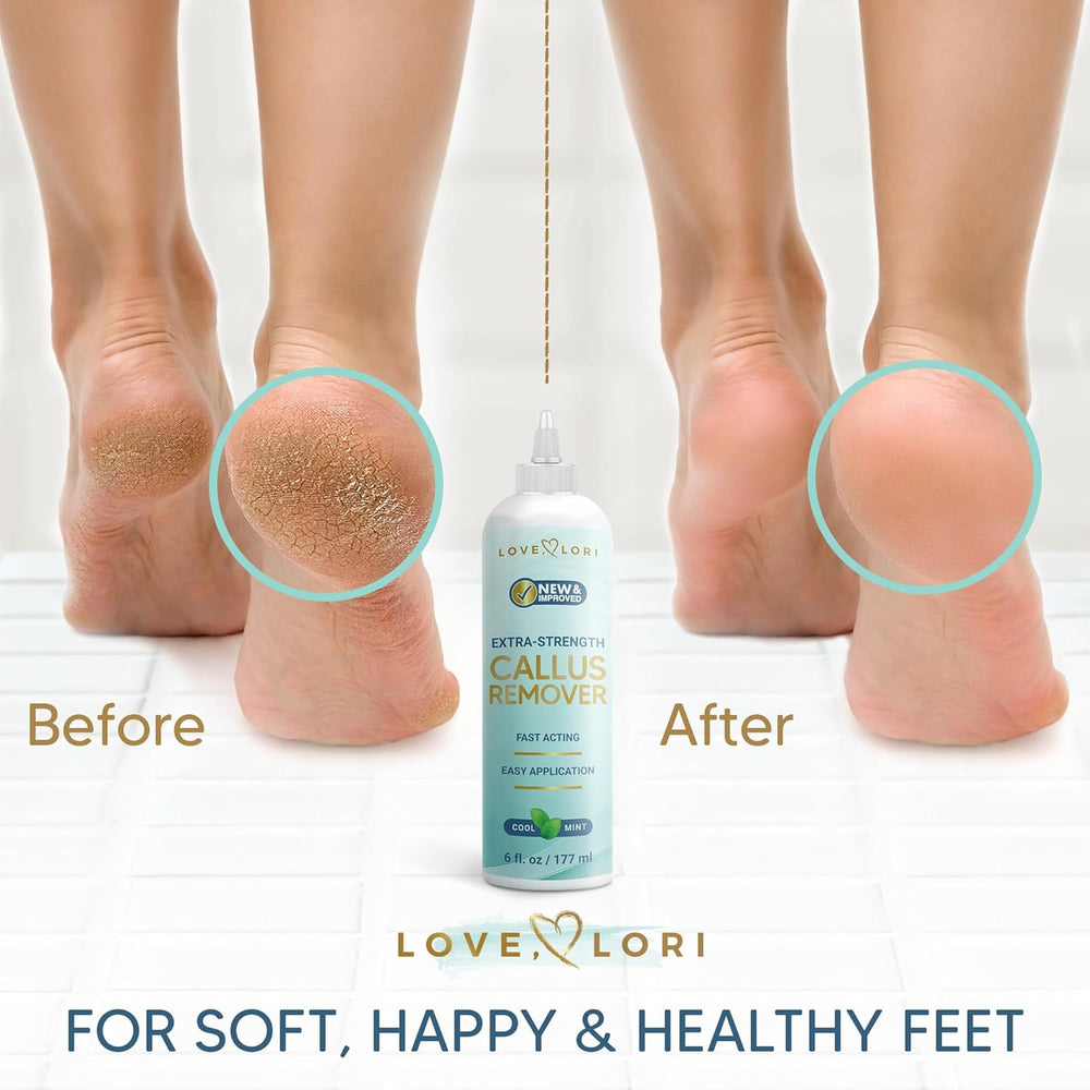 LOVE, LORI Callus Remover for Feet (Extra Strength) Foot Scrubber Dead Skin Callus Gel - Professional Pedicure Feet Scraper Spa Essential, 6oz