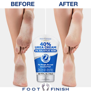 LOVE, LORI Urea Cream 40 Percent for Feet Maximum Strength - Urea 40% Cream plus 2% Salicylic Acid 4oz - Urea Foot Lotion for Feet, Heels, Hands & Elbows - Tea Tree Foot Cream for Dry feet