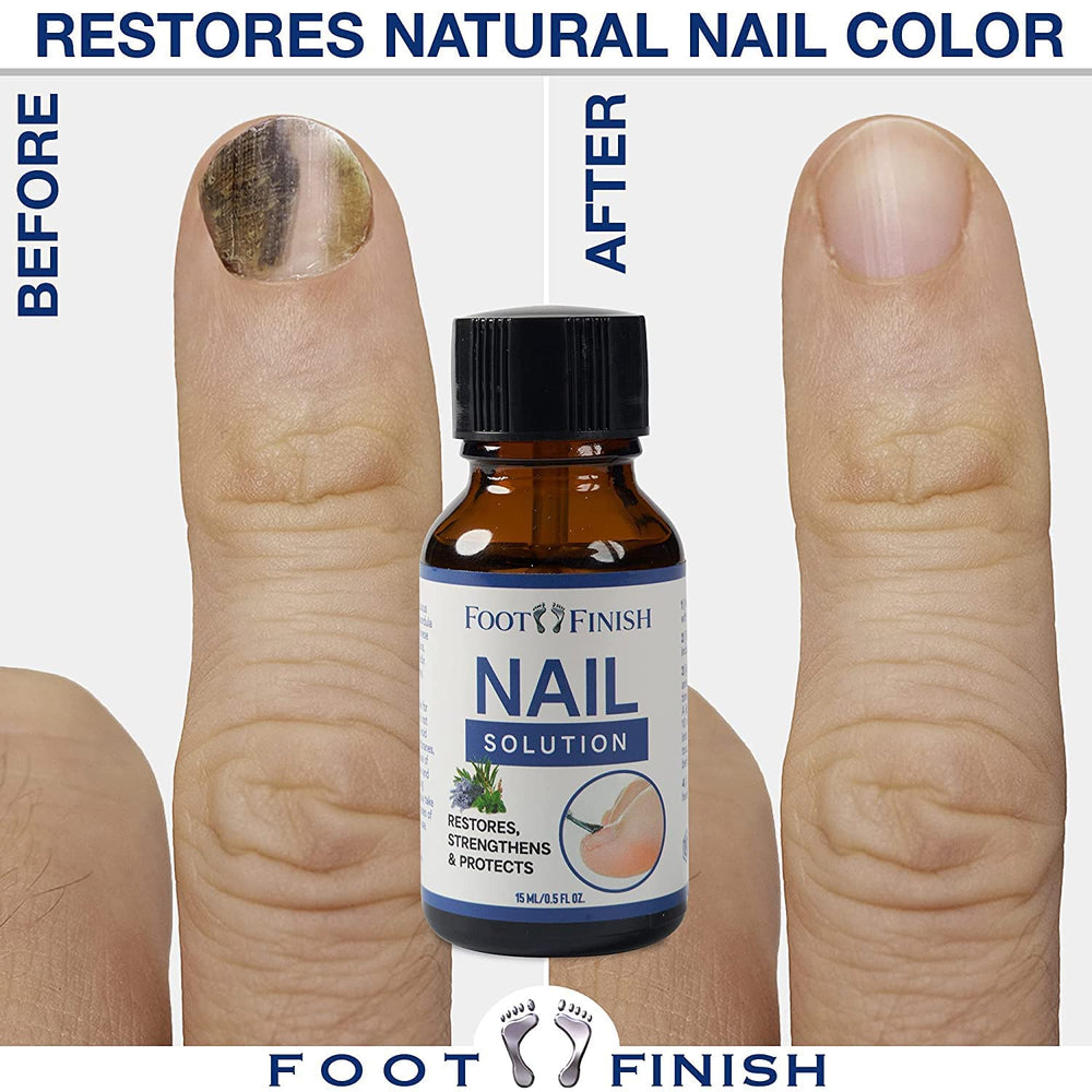 Foot Finish Nail Strengthener - Nail Tea Tree Oil for Toenail - Toenail for Discolored Nails to Restore & Protect