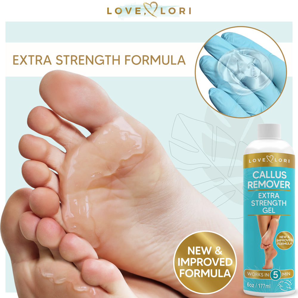 Foot Callus Remover Gel 6oz by Love, Lori - Callus Remover for Feet & Dead  Skin
