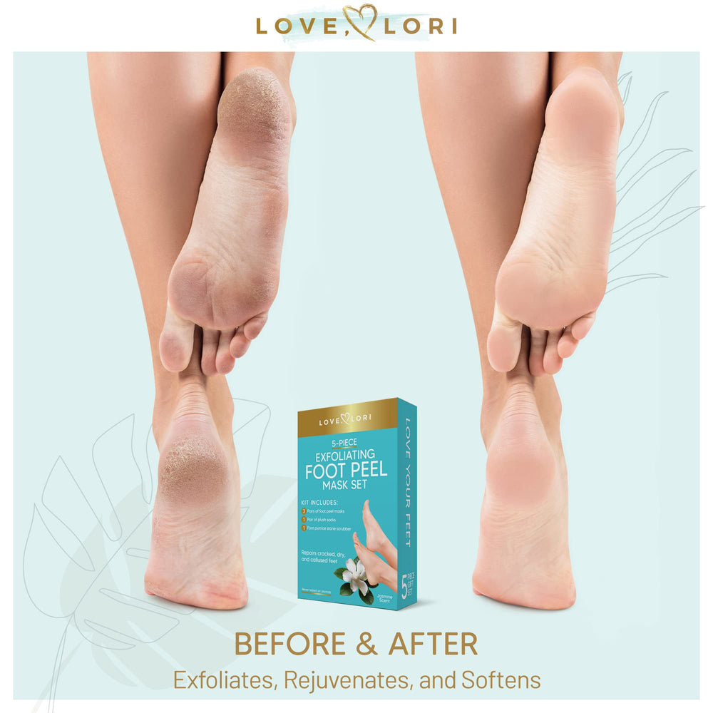 Hot Sale Vinegar Foot Masks For Smooth Exfoliation And Dead Skin Removal  Feet Skin Care Solution From Charm_girls, $29.64