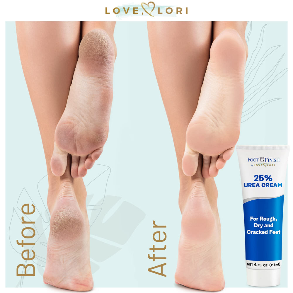 Buy Rabenda Foot Care Cream For Rough, Dry and Cracked Heel | Feet Cream  For Heel Repair |Healing softening cream (50 gm.) Pack of 1 Online In India  At Discounted Prices